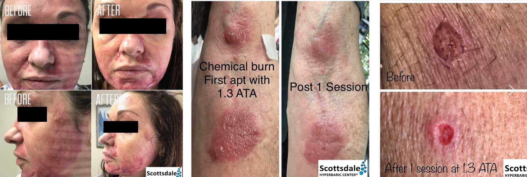 wound-examples